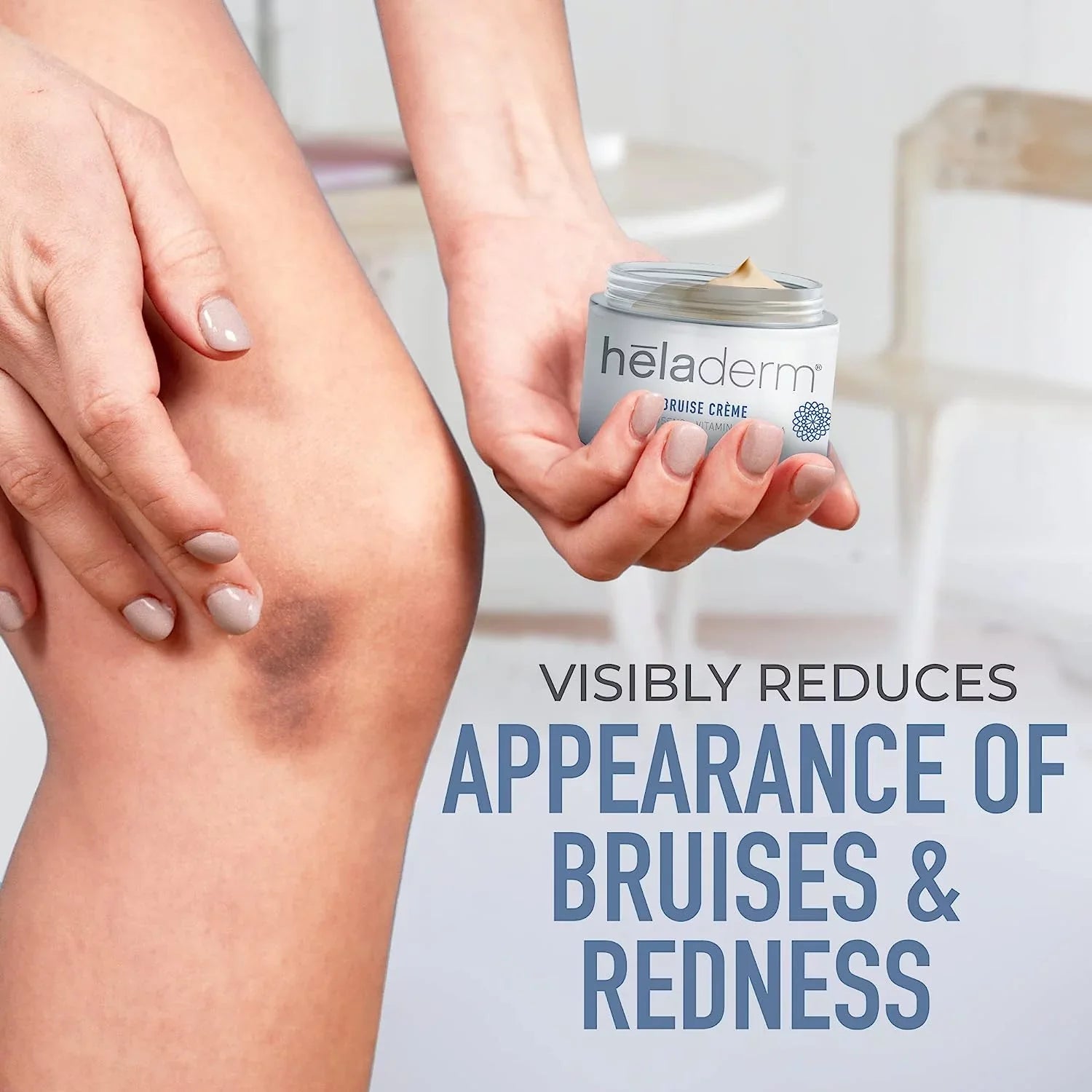 Heladerm Arnica Oil Bruise Cream, Fast Healing, Rejuvenates Sizekin, Bruise and Sizewelling Sizekincare, 1.7 oz